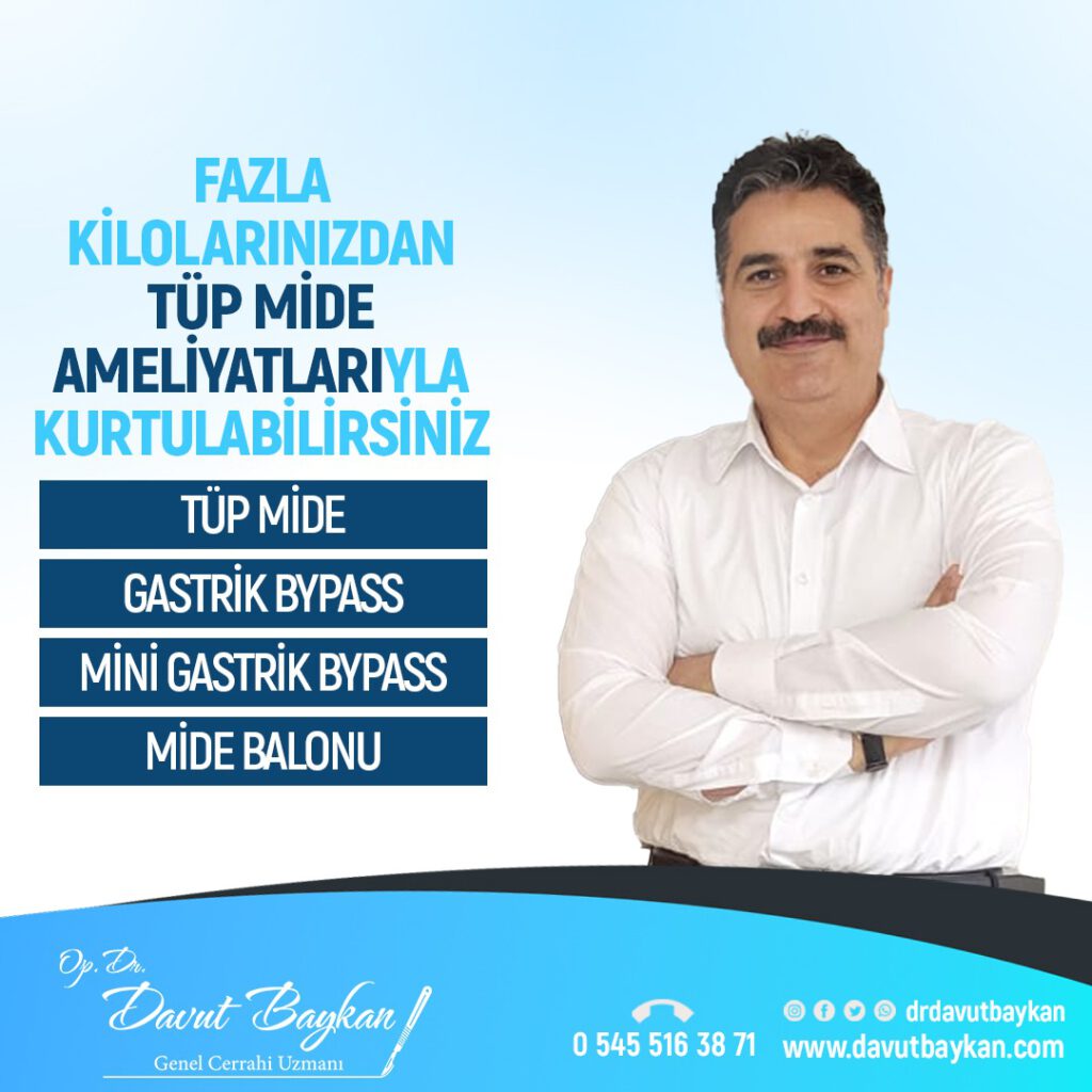 Fazla kilolarınızdan tüp mide ameliyatı ile kurtulabilirsiniz.
#tüpmideameliyatı